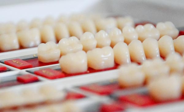 Zahnarztpraxis Bichler | Kolbermoor | Vollkeramische Restaurationen
